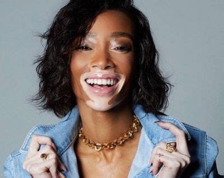 Winnie Harlow age