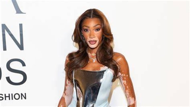 Winnie Harlow net worth